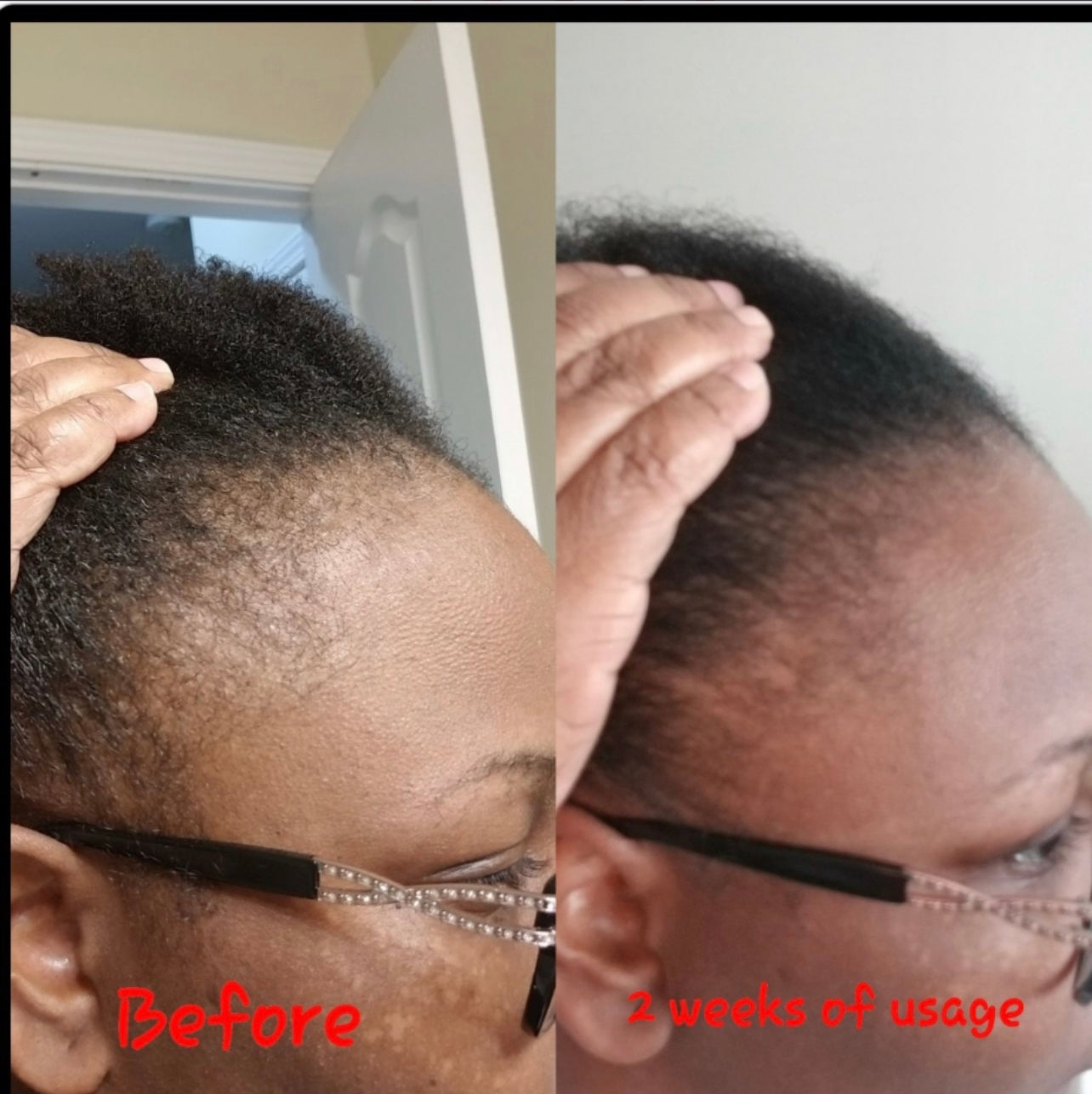 Hairline Renewal Temple Cream