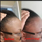 Hairline Renewal Temple Cream