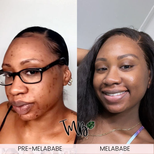 Glow Kit Trio