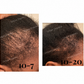Temple & Hairline Recovery Oil