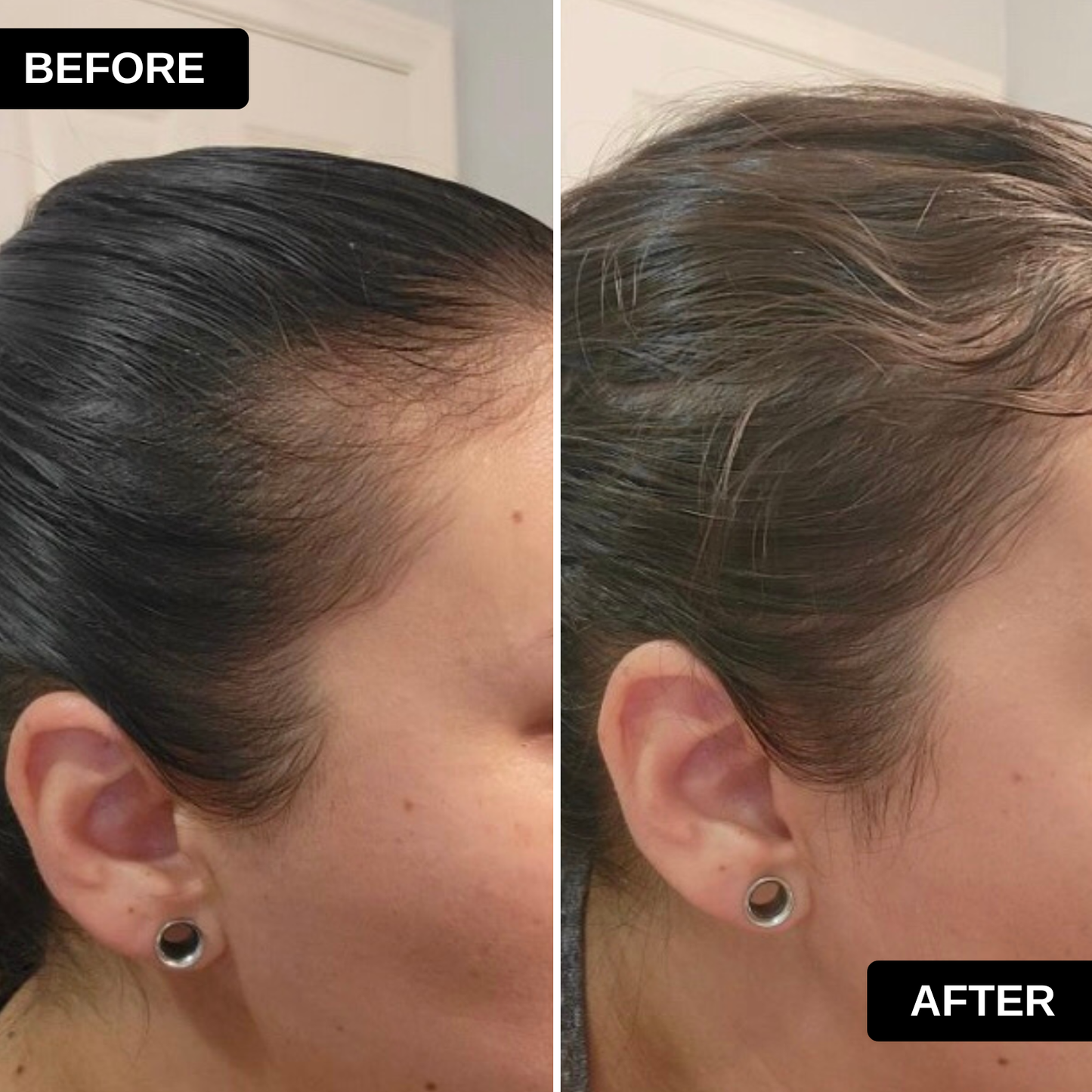 Temple & Hairline Recovery Oil