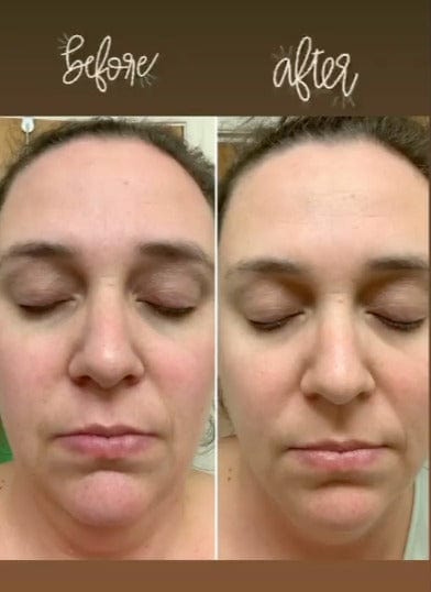 Hello Glow: Face Mask